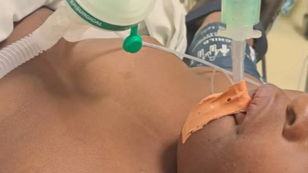Primera amigdalectomía por radiofrecuencia en Guinea Ecuatorial